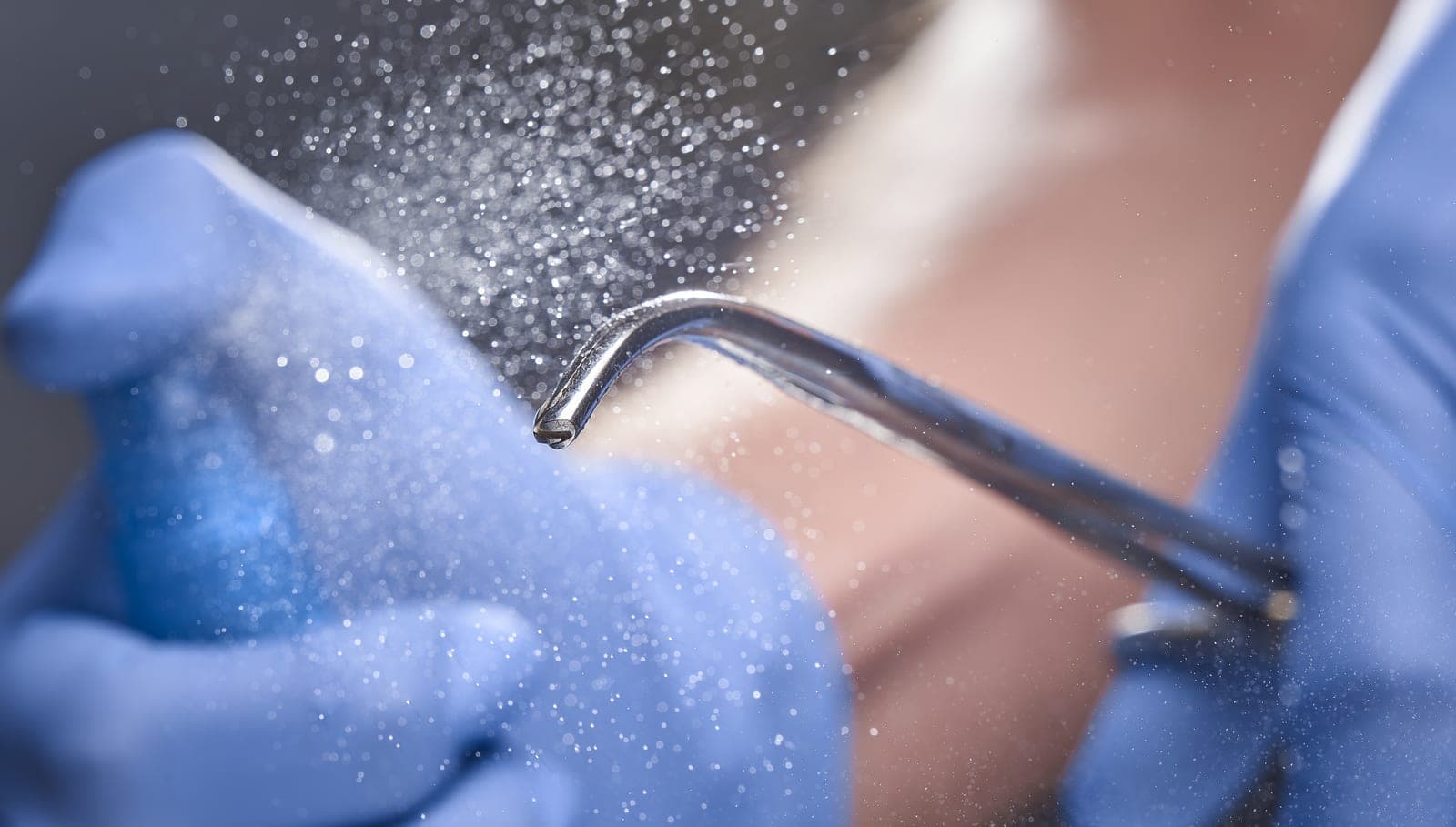 Careful, gentle gum disease treatment at Chapel House Dentistry