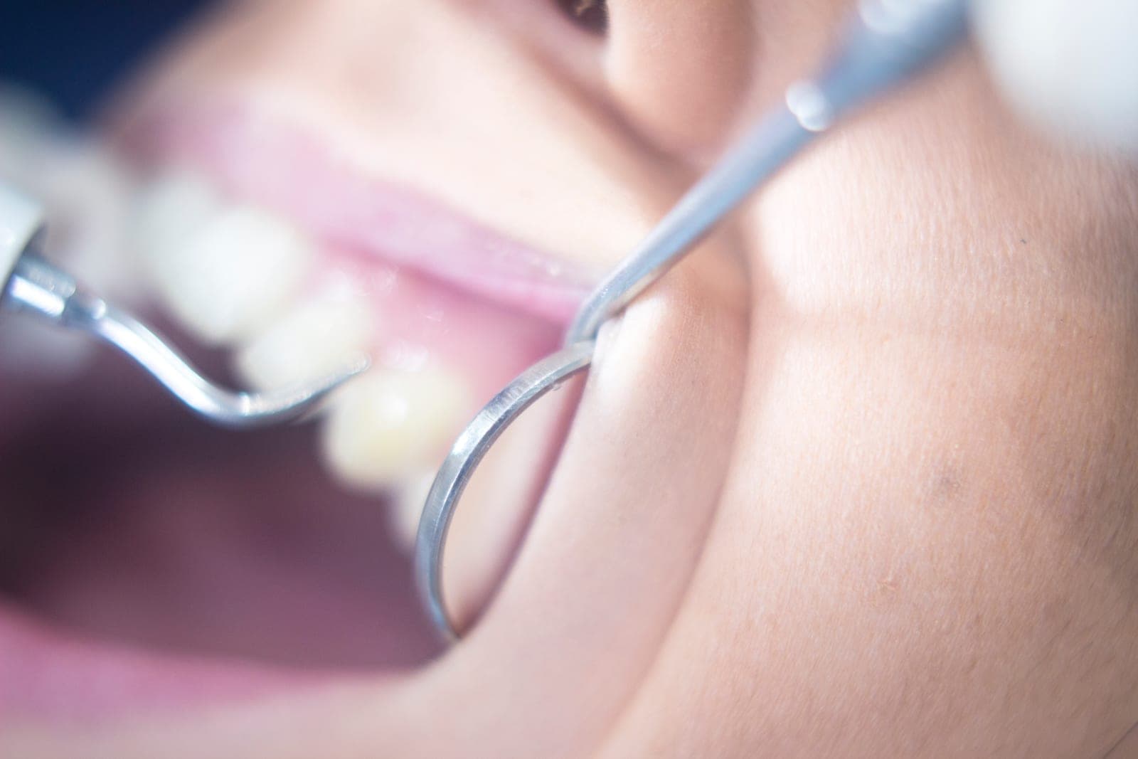 A hygienist providing a professional clean at Chapel House Dentistry in Hereford